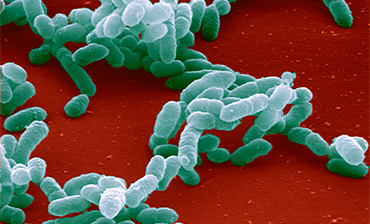 haemophilus influenzae