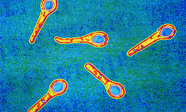 Prevention and control measures for tetanus
