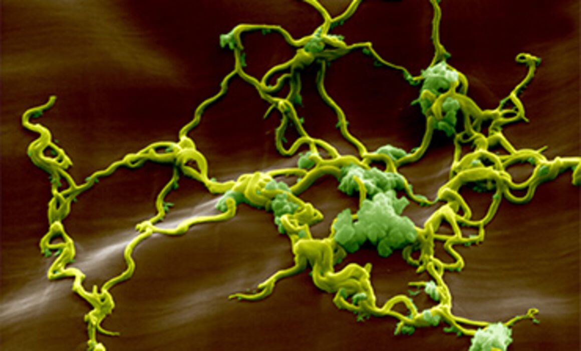 Lyme disease bacteria, Borrelia. © Science Photo Library