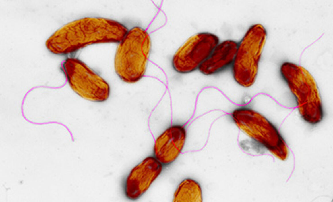 Cholera bacteria, TEM. © Science Photo Library