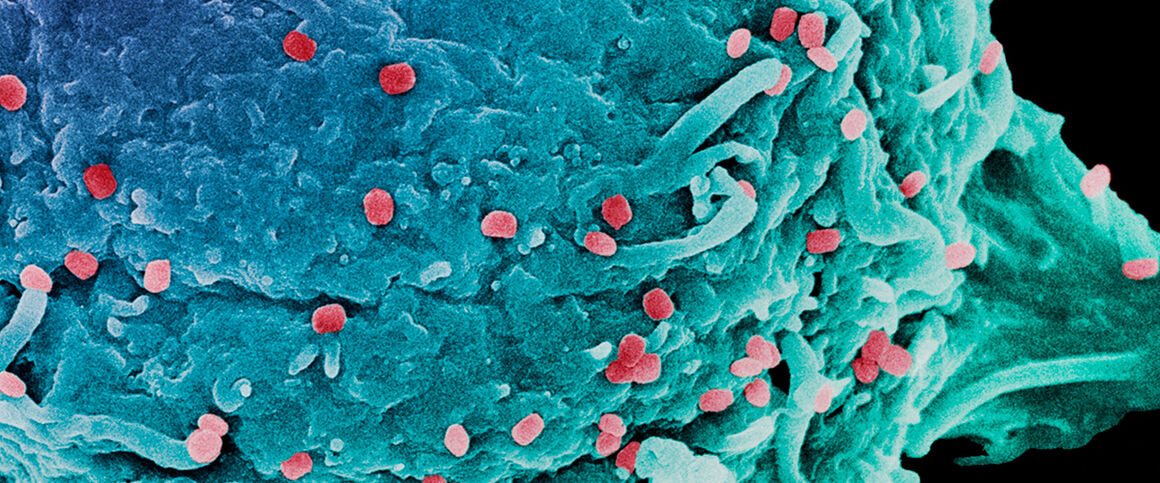 Vaccinia virus particles, SEM. © Science Photo Library