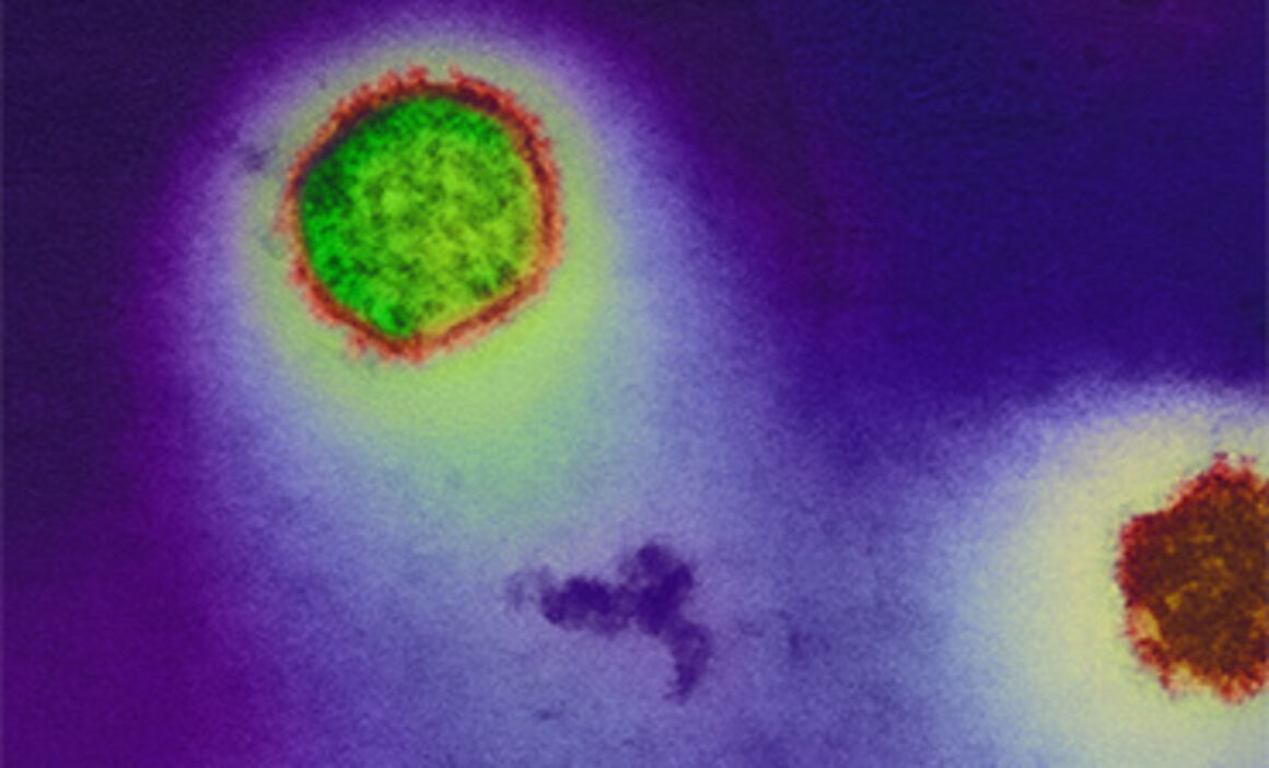 Hantavirus. © Science Photo Library