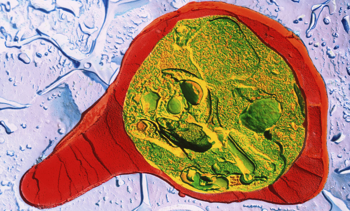 Travel-associated malaria cases: place of infection for cases imported to the European Union/European Economic Area