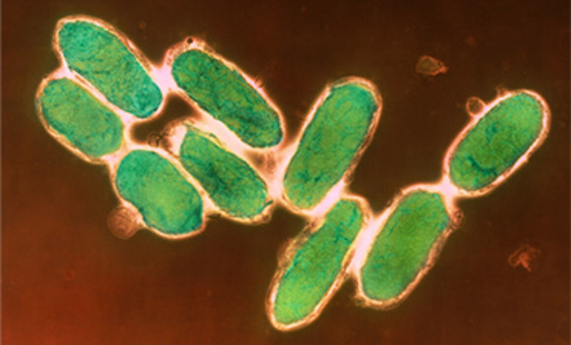 Yersinia pestis (plague) bacteria. © Science Photo Library