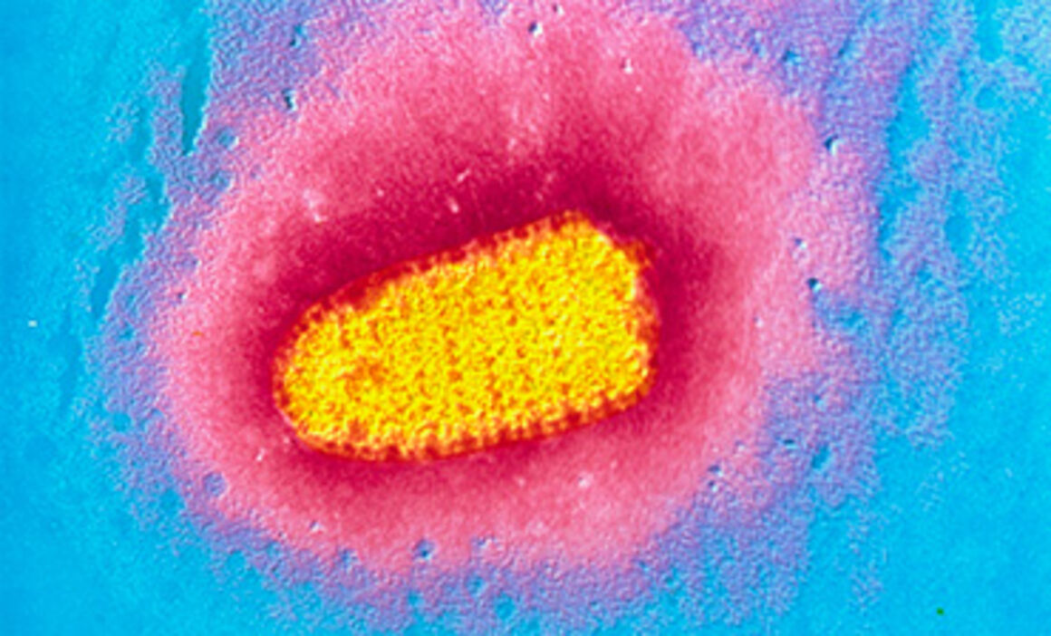 TEM of rabies virus. © Science Photo Library