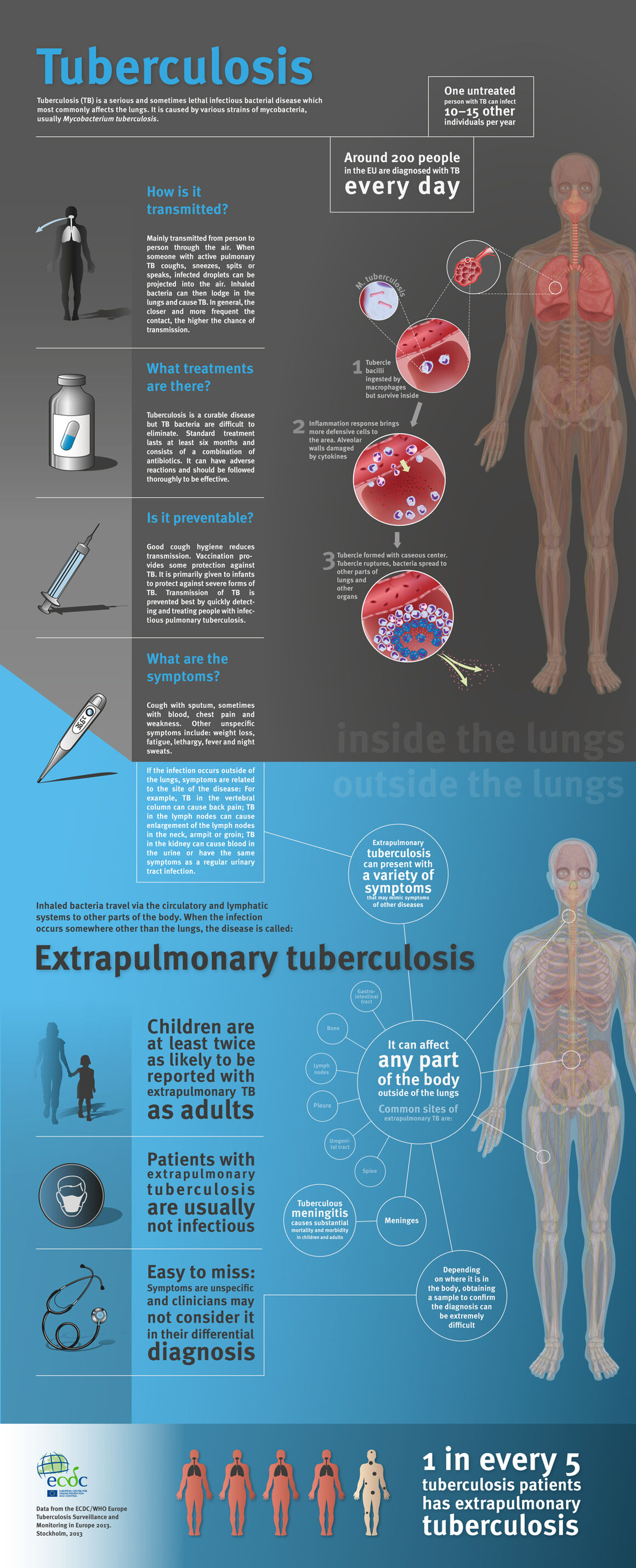 infographic explaining pulmonary and extrapulmonary tuberculosis