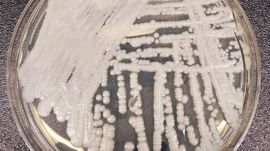 Candida_Auris_H Thumbnail