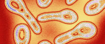 Diphtheria_C Thumbnail
