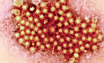 Hepatitis-C_H Thumbnail