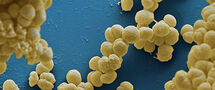 Meningococcal-disease_C Thumbnail