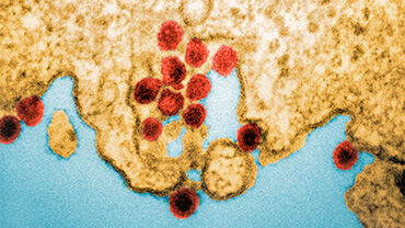 Chikungunya_H Thumbnail